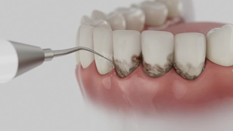 Trusted Wisdom Tooth Removal service in Scotia, NY - Dentist Open Now